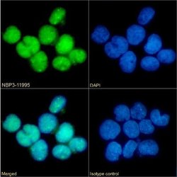 CCR5 Rabbit anti-Human, Clone: E11/19, Novus Biologicals 0.2 mg | Buy Online | Novus Biologicals | Fisher Scientific